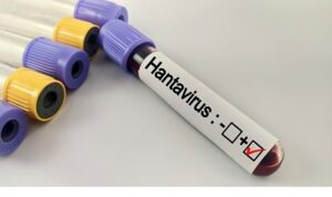 Hantavirüs Bir Salgına Dönüşür mü?