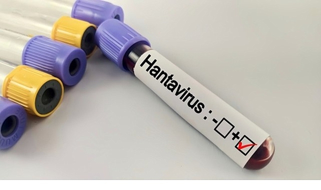 Hantavirüs Bir Salgına Dönüşür mü?